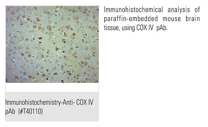 T40110_IHC.Jpeg