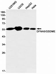 db11642-wb1.jpg