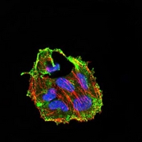 Cidec Core CIDEC Antibody_经典一抗